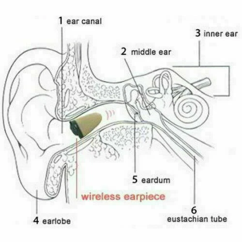 9 10 Pcs Titanium Alloy Invisible Wireless Hidden Micro In-ear Spy Earphone-Super Mini